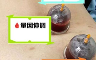 2026年4月点刺放血适宜日子 2026年3月点刺放血吉日查询