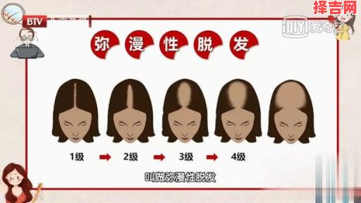 梦见掉头发预示什么?周公解梦解析掉发梦境含义-第1张图片 梦见掉头发预示什么?周公解梦解析掉发梦境含义-第1张图片